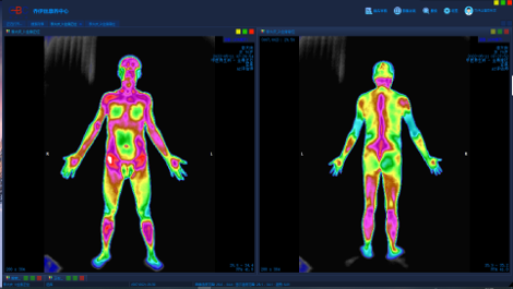 红外热成像AI健康评估系统
