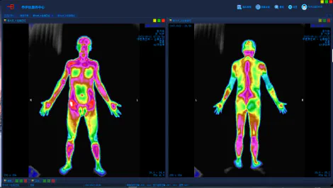 红外热成像AI辅助评估系统